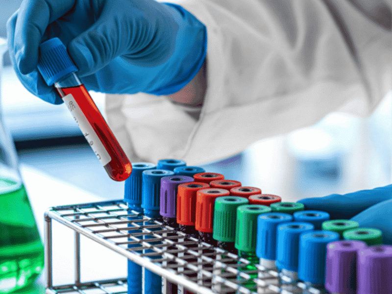 Why Phlebotomy Is One of the Best Entry-Level Healthcare Careers